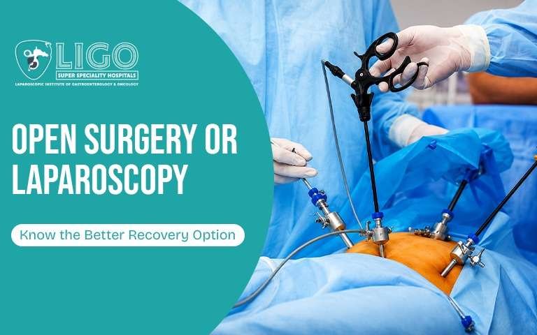 Why laparoscopic surgery is replacing traditional open surgery